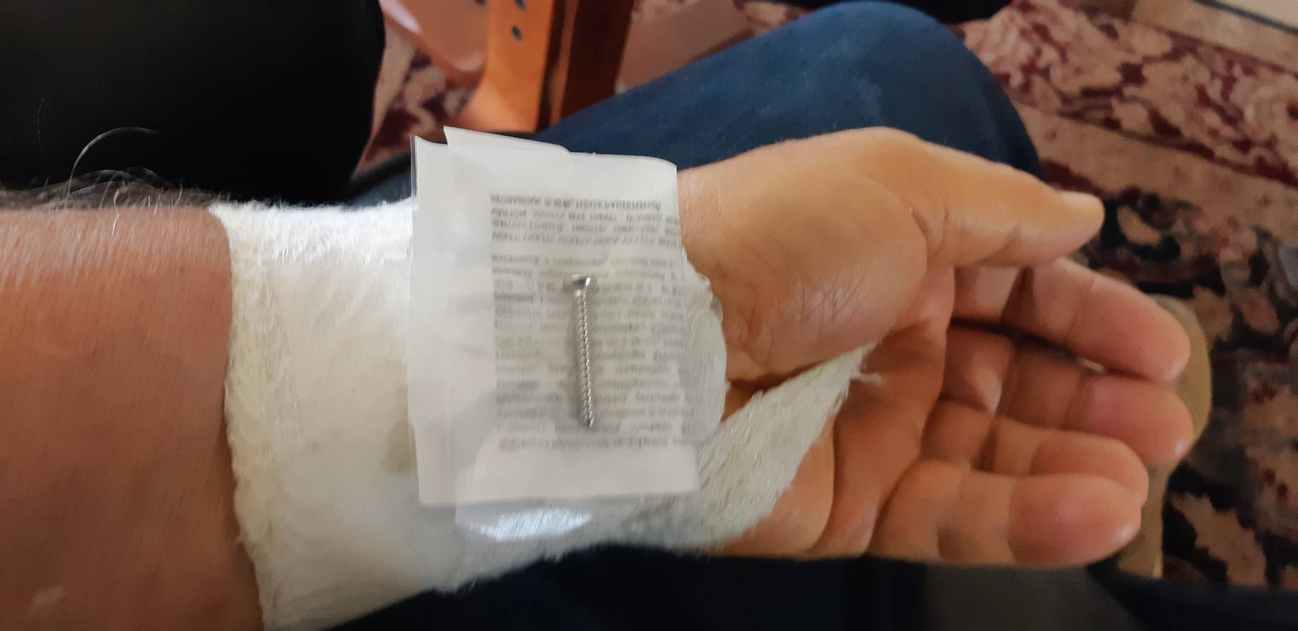 2019 05 29 - Skrue fra håndleddet mitt